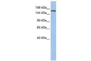 UBE3A antibody used at 1 ug/ml to detect target protein. (ube3a 抗体  (N-Term))