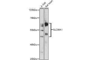 Western blot analysis of extracts of various cell lines, using SLC38 antibody (ABIN7270455) at 1:1000 dilution. (SLC38A1 抗体  (AA 1-70))