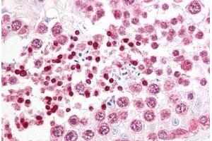 Anti-INADL antibody IHC staining of human testis. (PATJ 抗体  (AA 2-14))