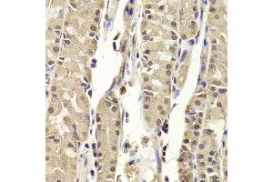 Immunohistochemistry of paraffin-embedded Human gastric using BLZF1 antibody at dilution of 1:100 (x400 lens). (BLZF1 抗体)