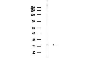 Western blot analysis of lysates from Hela cells(LPS 4h treatment), using CL Antibody at 1/1000 dilution.