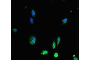 Immunofluorescent analysis of Hela cells using ABIN7150287 at dilution of 1:100 and Alexa Fluor 488-congugated AffiniPure Goat Anti-Rabbit IgG(H+L) (RAD51 抗体  (AA 1-228))