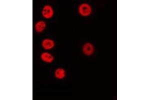 ABIN6274707 staining COLO205 by IF/ICC. (KLF7 抗体  (Internal Region))