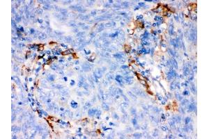 IHC analysis of FCGRT using anti-FCGRT antibody (ABIN3044521).