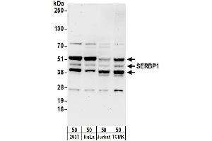 Western Blotting (WB) image for anti-SERPINE1 mRNA Binding Protein 1 (SERBP1) (AA 100-150) antibody (ABIN7454987) (SERBP1 抗体  (AA 100-150))