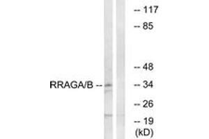 Western blot analysis of extracts from HepG2 cells, using RRAGA/B Antibody. (RRAGA/B 抗体  (AA 264-313))