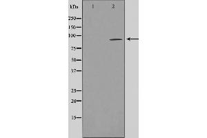 Western blot analysis on LOVO cell lysate using AKAP2 Antibody,The lane on the left is treated with the antigen-specific peptide. (AKAP2 抗体  (N-Term))
