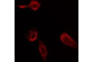 ABIN6275785 staining Hela cells by IF/ICC. (Phospholipase C beta 2 抗体  (Internal Region))
