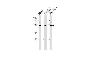 TERF2IP Antibody (C-term) (ABIN657968 and ABIN2846914) western blot analysis in Hela,HepG2,ZR-75-1 cell line lysates (35 μg/lane). (RAP1 抗体  (C-Term))