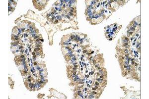 Image no. 1 for anti-Minichromosome Maintenance Deficient 8 (MCM8) (AA 717-766) antibody (ABIN6737804) (MCM8 抗体  (AA 717-766))