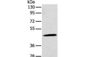 Western blot analysis of Rat kidney tissue using CCBL1 Polyclonal Antibody at dilution of 1:300 (CCBL1 抗体)