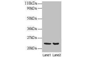 Western blot All lanes: PRDX1 antibody at 2 μg/mL Lane 1: EC109 whole cell lysate Lane 2: 293T whole cell lysate Secondary Goat polyclonal to rabbit IgG at 1/15000 dilution Predicted band size: 23 kDa Observed band size: 23 kDa (Peroxiredoxin 1 抗体  (AA 1-199))