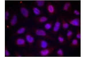Image no. 1 for anti-Myocyte Enhancer Factor 2A (MEF2A) (pThr312) antibody (ABIN196682) (MEF2A 抗体  (pThr312))