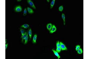 Immunofluorescent analysis of HepG2 cells using ABIN7170263 at dilution of 1:100 and Alexa Fluor 488-congugated AffiniPure Goat Anti-Rabbit IgG(H+L) (SLC46A3 抗体  (AA 26-73))