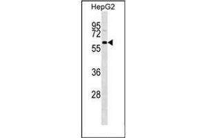 Western Blotting (WB) image for anti-GDNF Family Receptor alpha 3 (GFRA3) (AA 115-144), (Middle Region) antibody (ABIN952505)