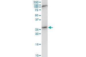 Western Blotting (WB) image for anti-SAP Domain Containing Ribonucleoprotein (SARNP) (AA 1-210) antibody (ABIN529666)