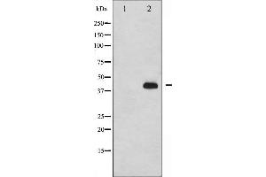 Western blot analysis of p47 phox phosphorylation expression in nocodazole treated HeLa whole cell lysates,The lane on the left is treated with the antigen-specific peptide. (NCF1 抗体  (pSer359))