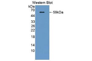 Western blot analysis of the recombinant protein. (SIGLEC8 抗体  (AA 70-336))