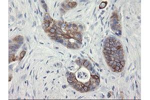 Image no. 4 for anti-Src-like-adaptor 2 (SLA2) antibody (ABIN1500948)