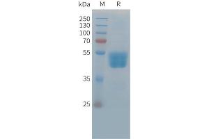 SDS-PAGE (SDS) image for T Cell Immunoreceptor with Ig and ITIM Domains (TIGIT) (AA 27-209) protein (Fc Tag) (ABIN7538539)