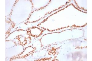 IHC: Formalin-fixed, paraffin-embedded human thyroid stained with recombinant NKX2. (NKX2-1 抗体)