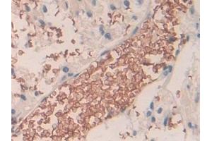 Immunohistochemistry (IHC) image for anti-Solute Carrier Family 4, Anion Exchanger, Member 1 (erythrocyte Membrane Protein Band 3, Diego Blood Group) (SLC4A1) (AA 35-290) antibody (ABIN7441895)
