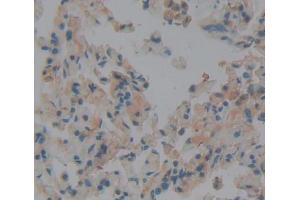 Used in DAB staining on fromalin fixed paraffin- embedded lung tissue (DICER1 抗体  (AA 6-290))