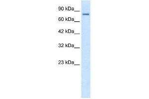 WB Suggested Anti-KCNN3  Antibody Titration: 0. (KCNN3 抗体  (C-Term))