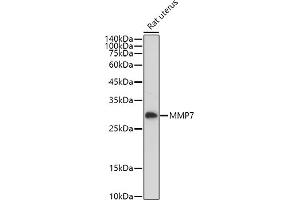 Western blot analysis of extracts of Rat uterus, using MMP7 antibody (ABIN3021102, ABIN3021103, ABIN3021104, ABIN1513214 and ABIN6213952) at 1:1000 dilution. (MMP7 抗体  (AA 18-267))