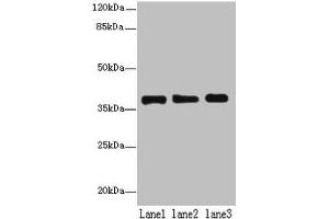 Western blot All lanes: MRPL44 antibody at 6 μg/mL Lane 1: Hela whole cell lysate Lane 2: Jurkat whole cell lysate Lane 3: K562 whole cell lysate Secondary Goat polyclonal to rabbit IgG at 1/10000 dilution Predicted band size: 38 kDa Observed band size: 38 kDa (MRPL44 抗体  (AA 31-332))