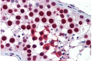 Immunohistochemistry (Formalin-fixed Paraffin-embedded Sections) (IHC (fp)) image for anti-KH Domain Containing, RNA Binding, Signal Transduction Associated 1 (KHDRBS1) (AA 359-408) antibody (ABIN6747056)