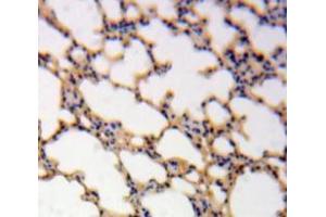 Used in DAB staining on fromalin fixed paraffin-embedded Lung tissue (IL-1 beta 抗体  (AA 117-269))