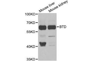 Western blot analysis of extracts of various cell lines, using BTD antibody. (BTD 抗体)