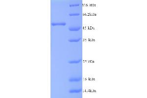 SDS-PAGE (SDS) image for Casein Kinase 1, epsilon (CSNK1E) (AA 1-416), (full length) protein (His tag) (ABIN5713380) (CK1 epsilon Protein (AA 1-416, full length) (His tag))
