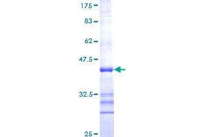 Image no. 1 for Cannabinoid Receptor 1 (CNR1) (AA 1-110) protein (GST tag) (ABIN1349881)
