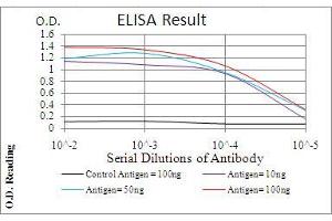 Black line: Control Antigen (100 ng), Purple line: Antigen(10 ng), Blue line: Antigen (50 ng), Red line: Antigen (100 ng), (Phospholipase C gamma 2 抗体  (AA 826-985))