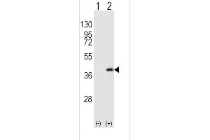 Western Blotting (WB) image for anti-Protein Phosphatase 1, Catalytic Subunit, beta Isoform (PPP1CB) (AA 286-315), (C-Term) antibody (ABIN392847)
