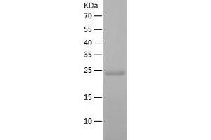 DCXR Protein (AA 1-244) (His tag)