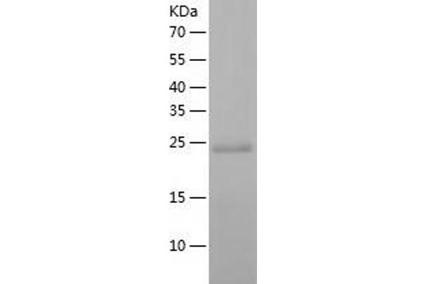 DCXR Protein (AA 1-244) (His tag)