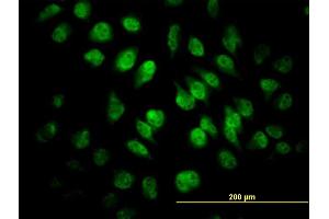 Immunofluorescence of monoclonal antibody to SAFB on HeLa cell. (SAFB 抗体  (AA 111-200))