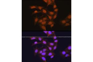 Immunofluorescence analysis of U-2 OS cells using 67 kDa Laminin Receptor Rabbit pAb (ABIN6128199, ABIN6147247, ABIN6147248 and ABIN6224857) at dilution of 1:100 (40x lens). (RPSA/Laminin Receptor 抗体  (AA 1-295))