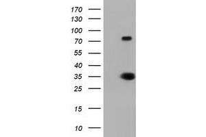 HEK293T cells were transfected with the pCMV6-ENTRY control (Left lane) or pCMV6-ENTRY ERCC1 (Right lane) cDNA for 48 hrs and lysed. (ERCC1 抗体)