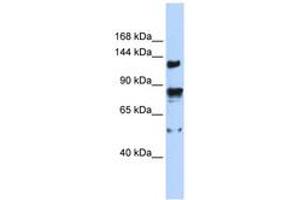 Image no. 1 for anti-Transient Receptor Potential Cation Channel, Subfamily M, Member 4 (TRPM4) (AA 359-408) antibody (ABIN6742557) (TRPM4 抗体  (AA 359-408))