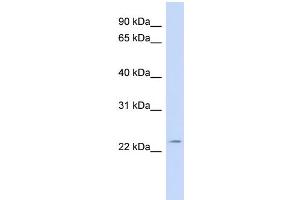WB Suggested Anti-FGF11 Antibody Titration: 0. (FGF11 抗体  (N-Term))