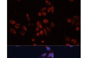 Immunofluorescence analysis of HeLa cells using GPC4 Polyclonal Antibody at dilution of 1:100. (GPC4 抗体)
