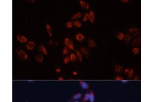 Immunofluorescence analysis of HeLa cells using GPC4 Polyclonal Antibody at dilution of 1:100. (GPC4 抗体)