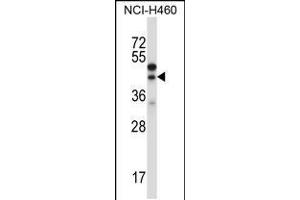Western blot analysis in NCI-H460 cell line lysates (35ug/lane). (CTGF 抗体  (AA 166-193))