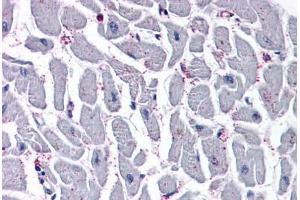 Anti-CYSLTR2 / CYSLT2 antibody  ABIN1048491 IHC staining of human heart. (CasLTR2 抗体  (N-Term))