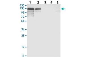 Western blot analysis of Lane 1: RT-4, Lane 2: U-251 MG, Lane 3: Human Plasma, Lane 4: Liver, Lane 5: Tonsil with NHSL1 polyclonal antibody  at 1:250-1:500 dilution. (NHSL1 抗体)