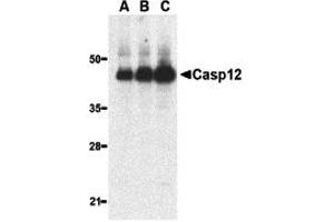 Western Blotting (WB) image for anti-Caspase 12 (Gene/pseudogene) (CASP12) (Large Isoform) antibody (ABIN1031699) (Caspase 12 抗体  (Large Isoform))
